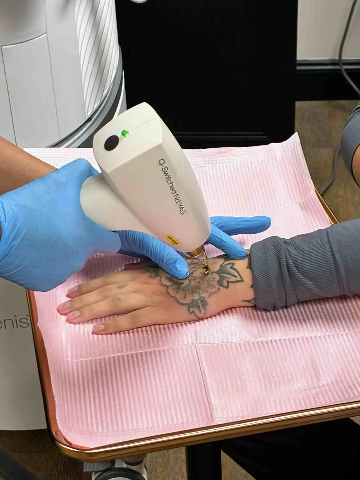 Tattoo Removal in Knoxville,TN by Pearl Scott Health & Beauty